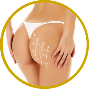 Levantamiento de glúteos