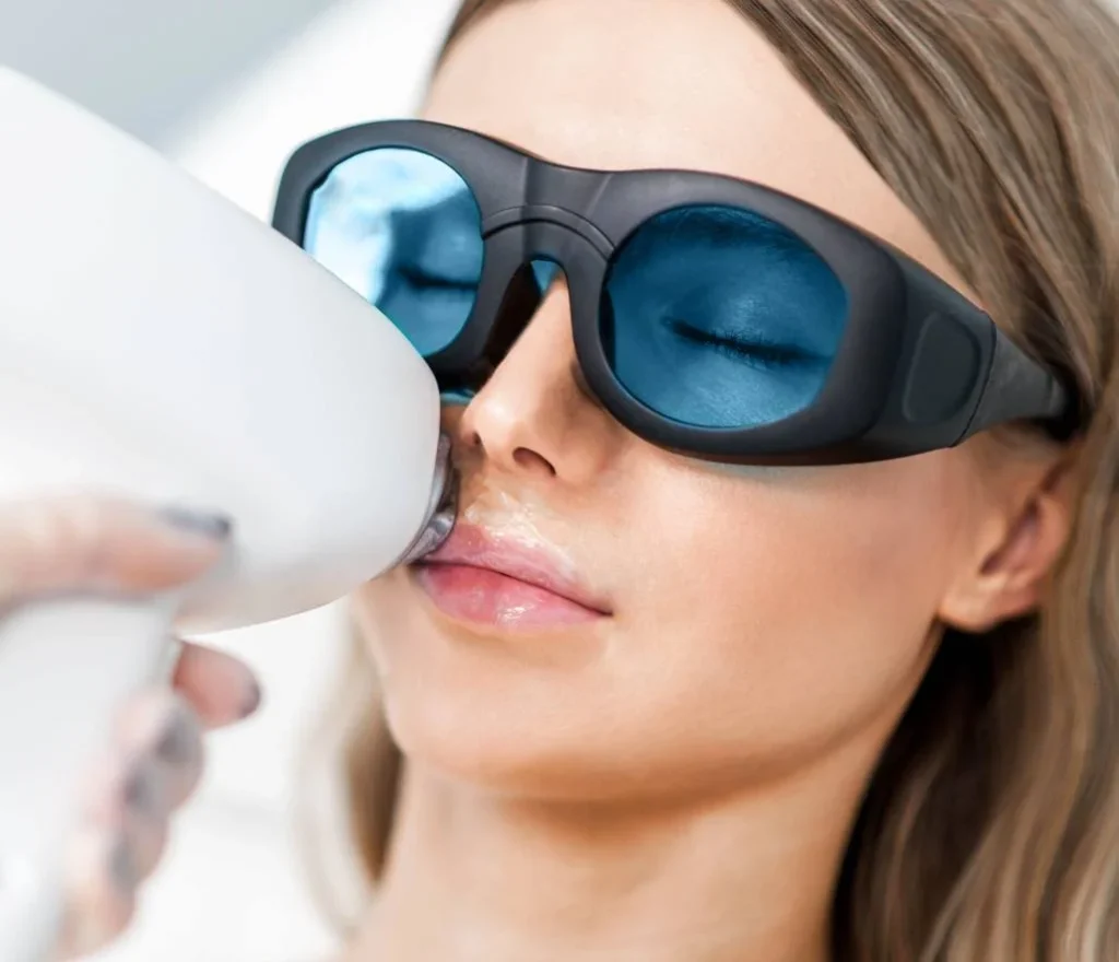 Laser facial